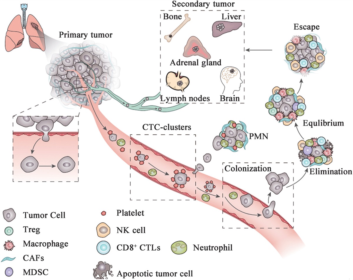 Tumor immune microenvironment-modulated nanostrategy for the treatment of lung cancer metastasis