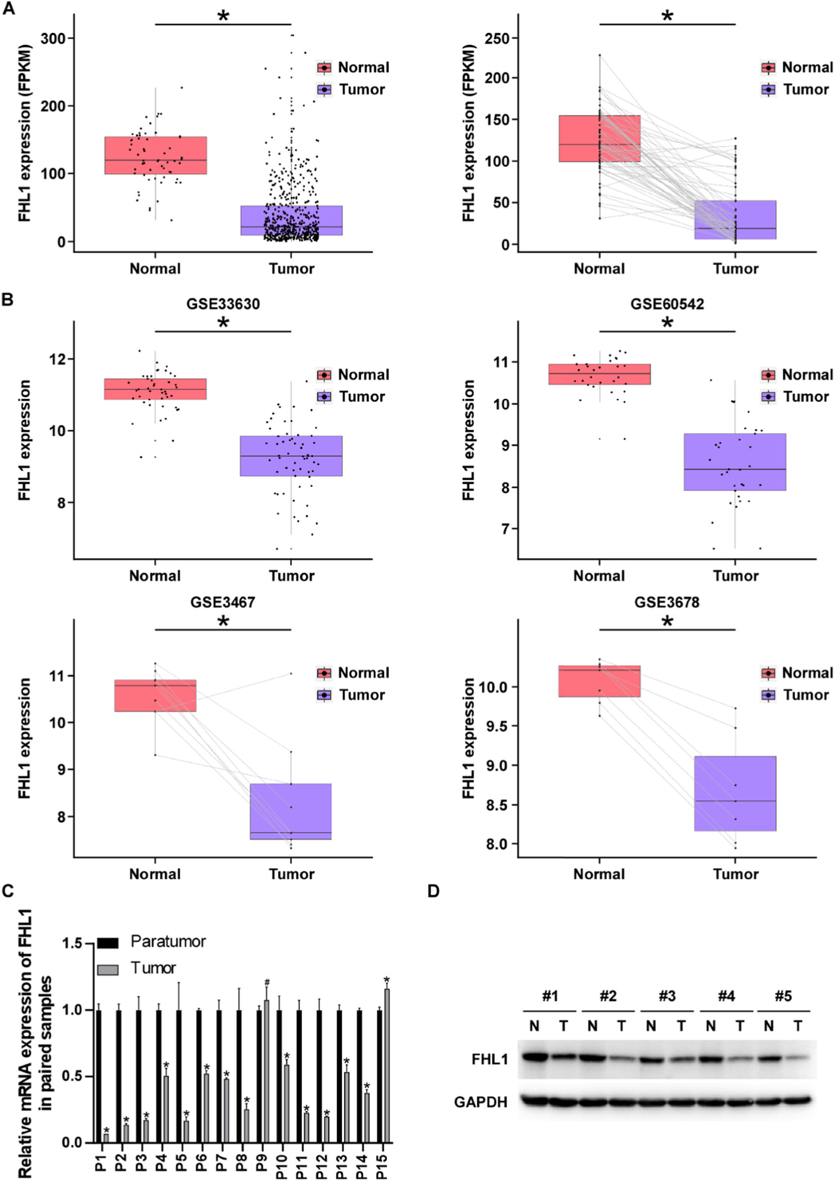 Overexpression of FHL1 suppresses papillary thyroid cancer proliferation and progression via inhibiting Wnt/β-catenin pathway