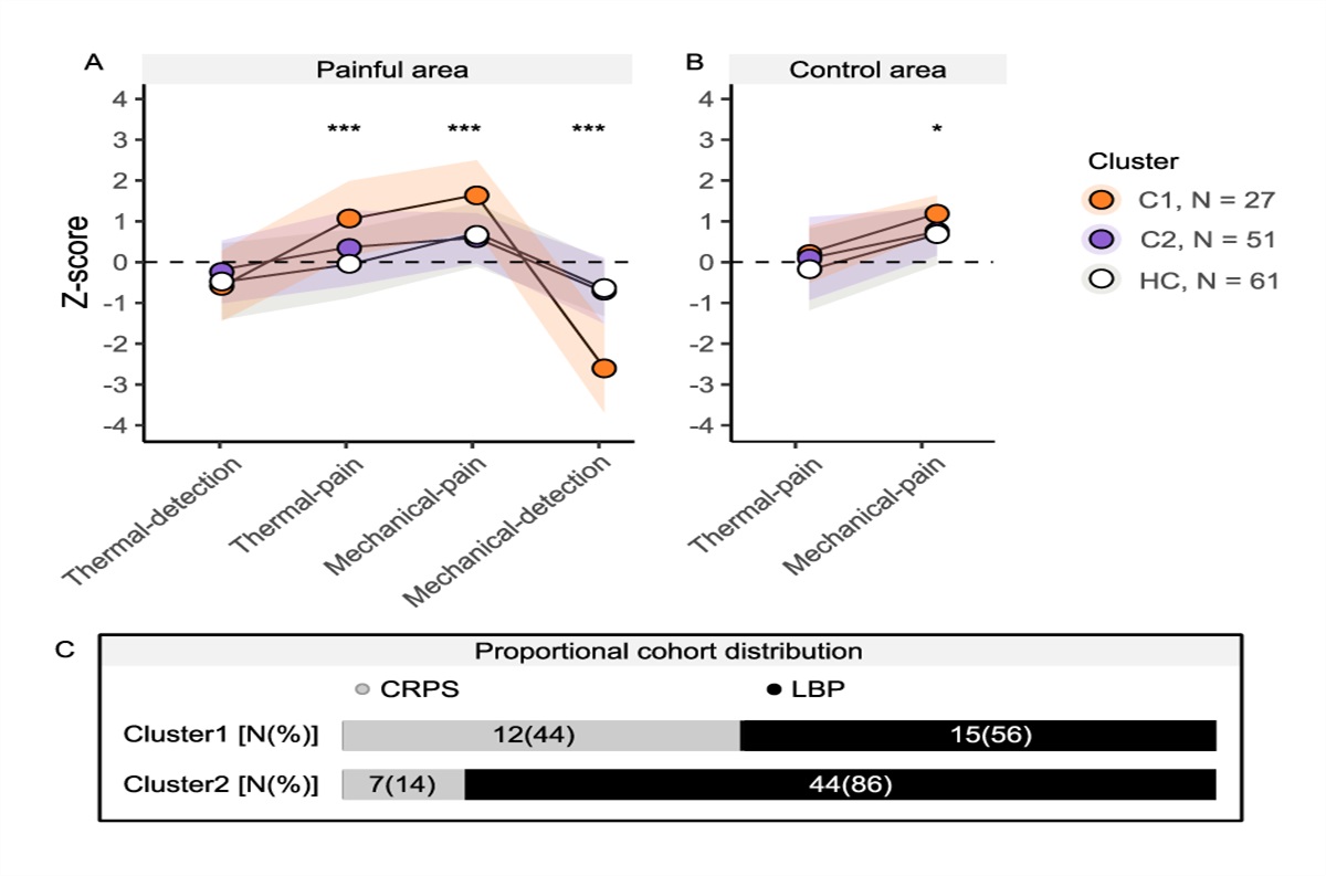 Sensory phenotypes in complex regional pain syndrome and chronic low back pain—indication of common underlying pathomechanisms