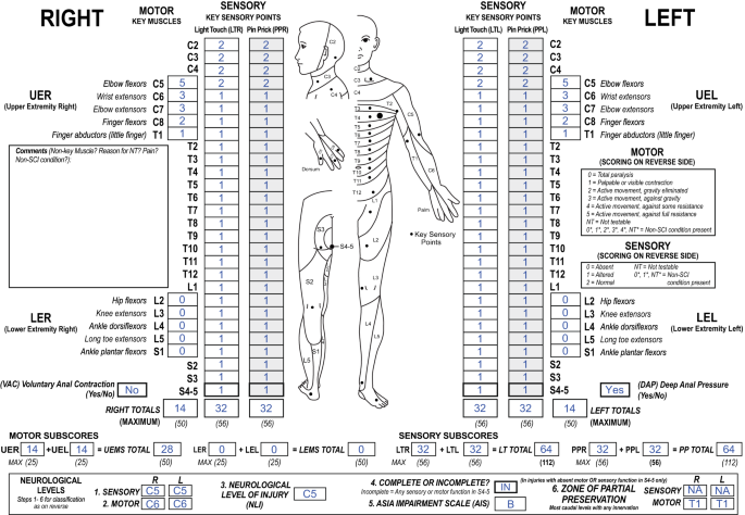 The revised zone of partial preservation (ZPP) in the 2019 International Standards for Neurological Classification of Spinal Cord Injury: ZPP applicability in incomplete injuries