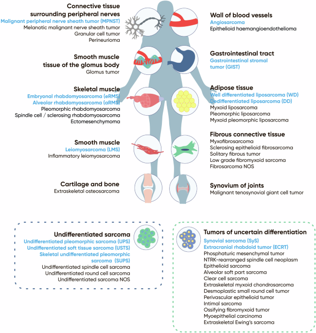 Soft tissue sarcomas at the single-cell and spatial resolution: new markers and targets