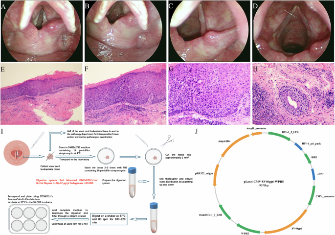 Establishment and characterization of the first immortalized vocal cord leukoplakia epithelial cell line