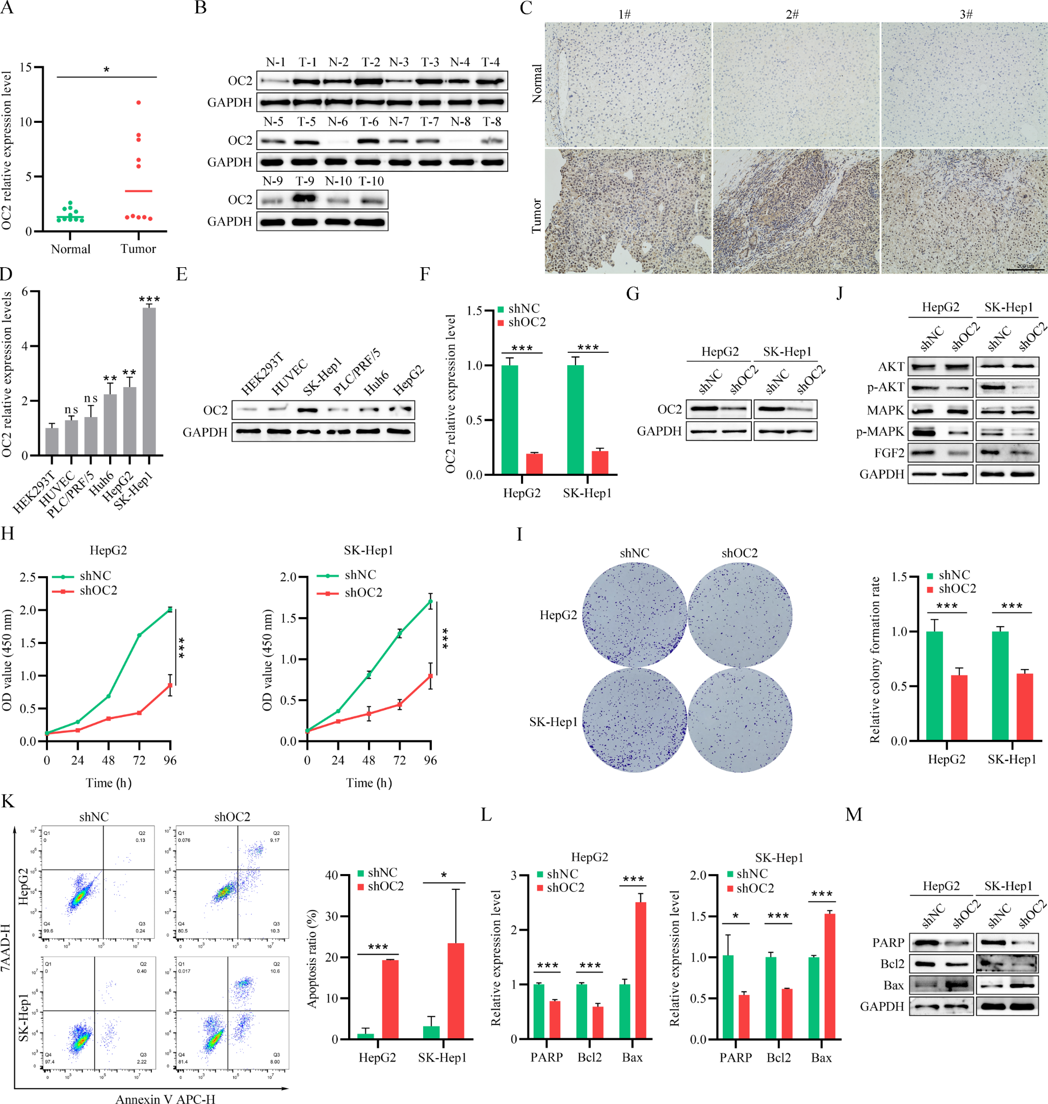 Knockout of onecut2 inhibits proliferation and promotes apoptosis of tumor cells through SKP2-mediated p53 acetylation in hepatocellular carcinoma