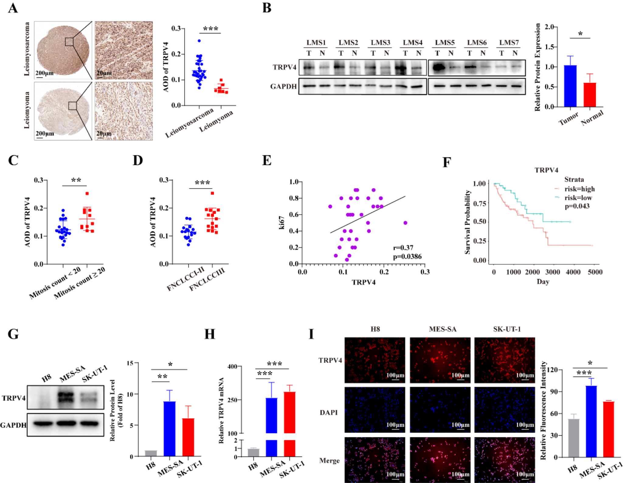 TRPV4 drives the progression of leiomyosarcoma by promoting ECM1 generation and co-activating the FAK/PI3K/AKT/GSK3β pathway