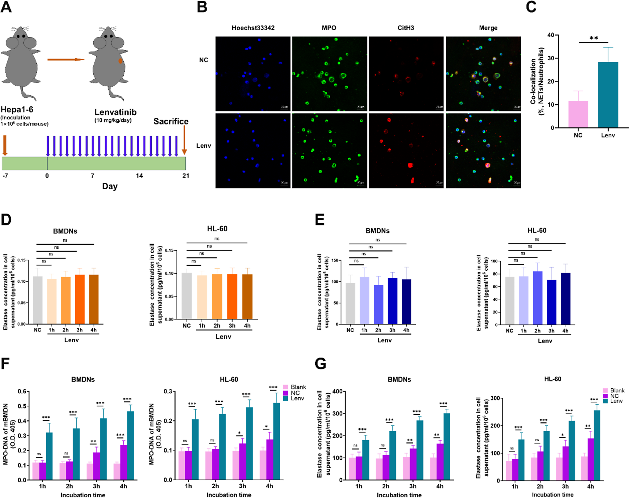 Lenvatinib-activated NDUFA4L2/IL33/PADI4 pathway induces neutrophil extracellular traps that inhibit cuproptosis in hepatocellular carcinoma
