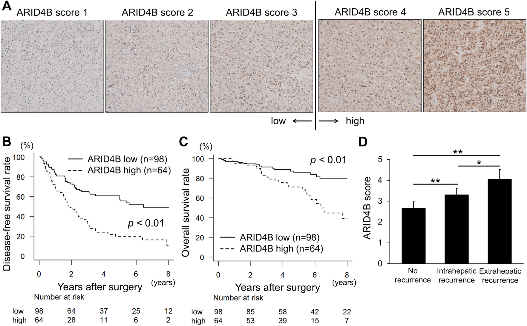 ARID4B Promotes the Progression of Hepatocellular Carcinoma Through the PI3K/AKT Pathway