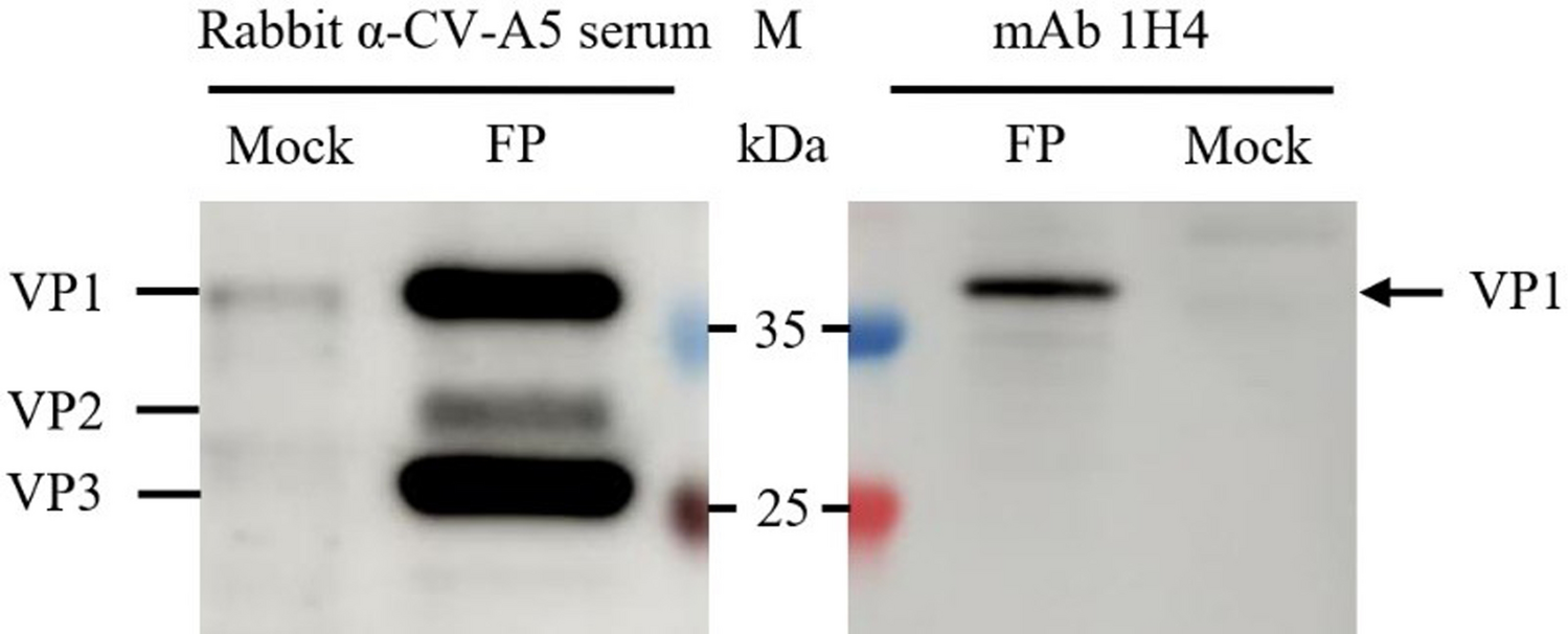 Discovery of a broad-spectrum monoclonal antibody recognizing a conserved, linear epitope WFYDGYPT on VP1 protein of Enterovirus A species