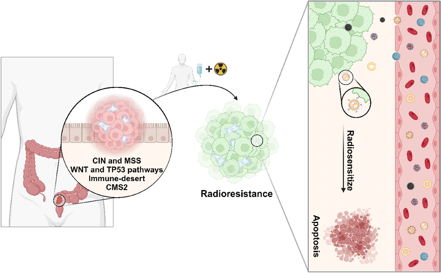 Radioresistance in rectal cancer: can nanoparticles turn the tide?