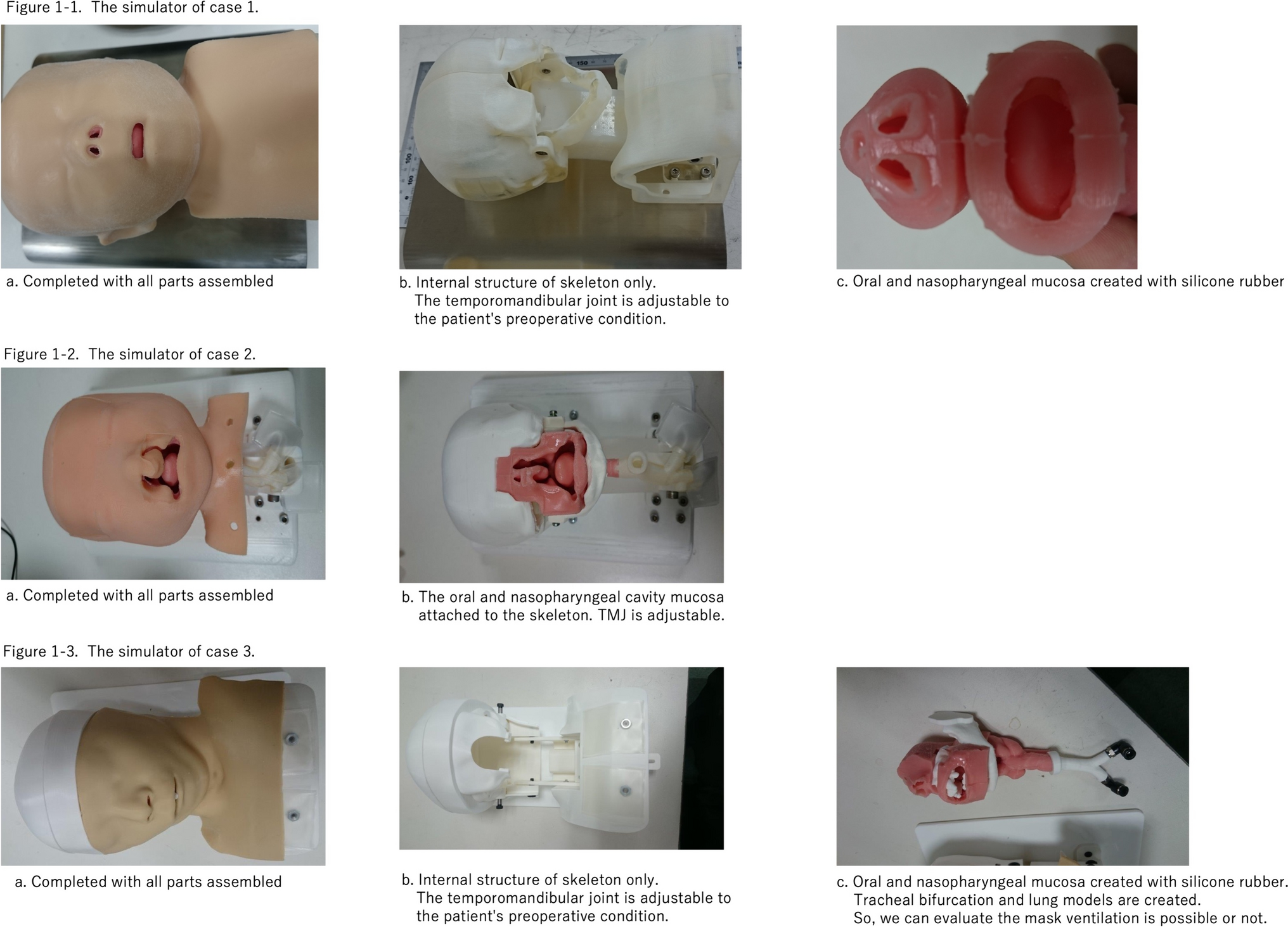 Investigation of the effectiveness of preoperative intubation simulation using a custom-made simulator for pediatric patients with difficult airway: a pilot study