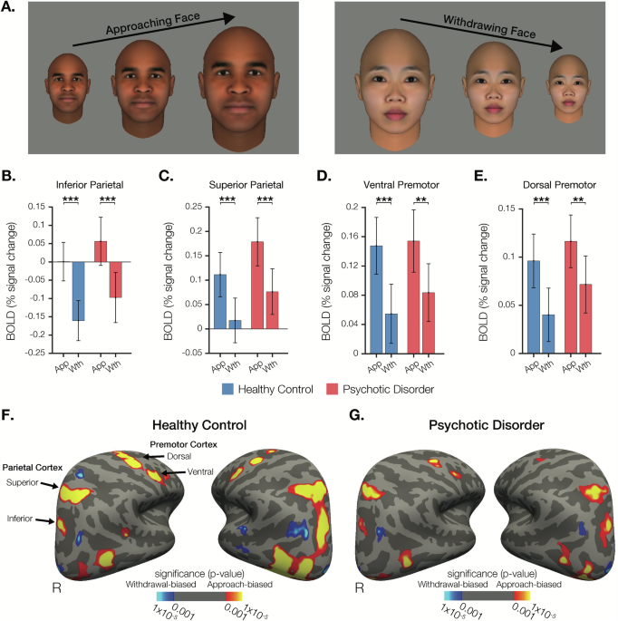 Neural correlates of personal space regulation in psychosis: role of the inferior parietal cortex