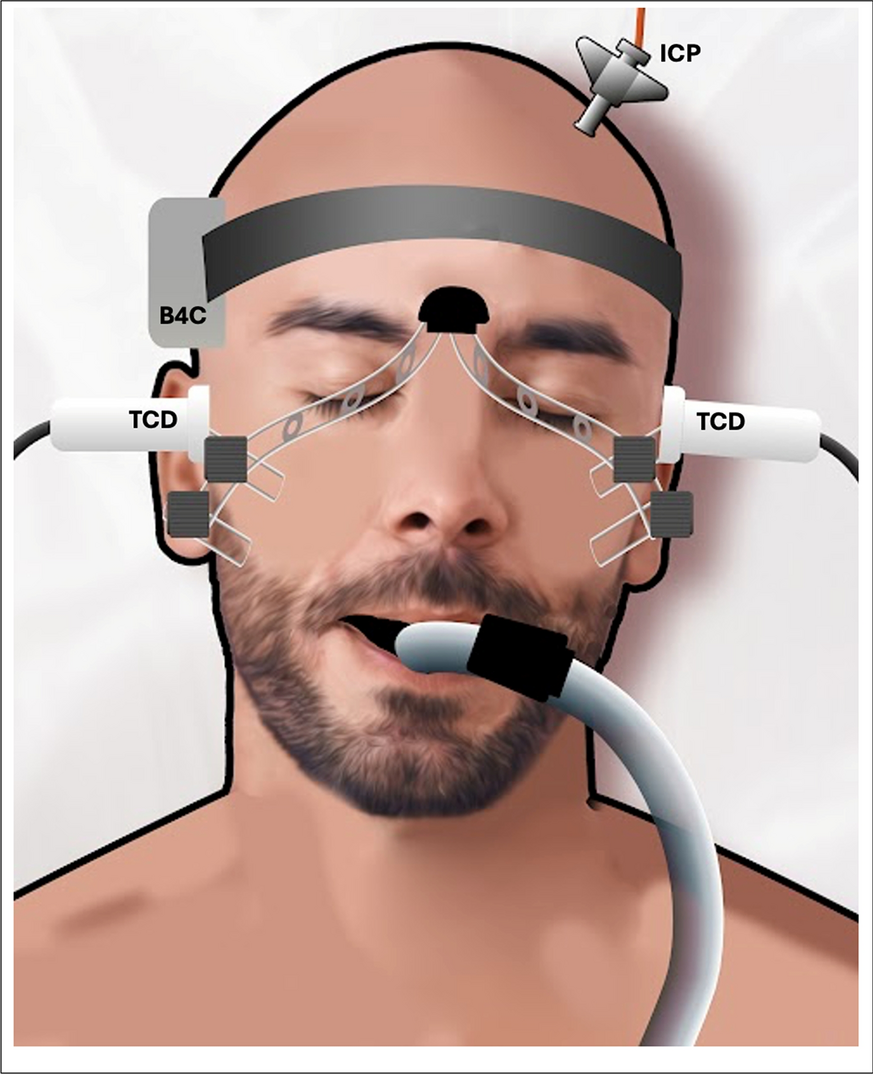 Validation of a Noninvasive Approach for Cerebrospinal Compliance Monitoring