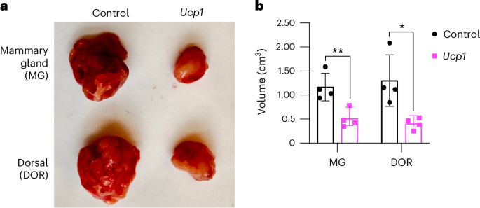 Starving tumors with fat