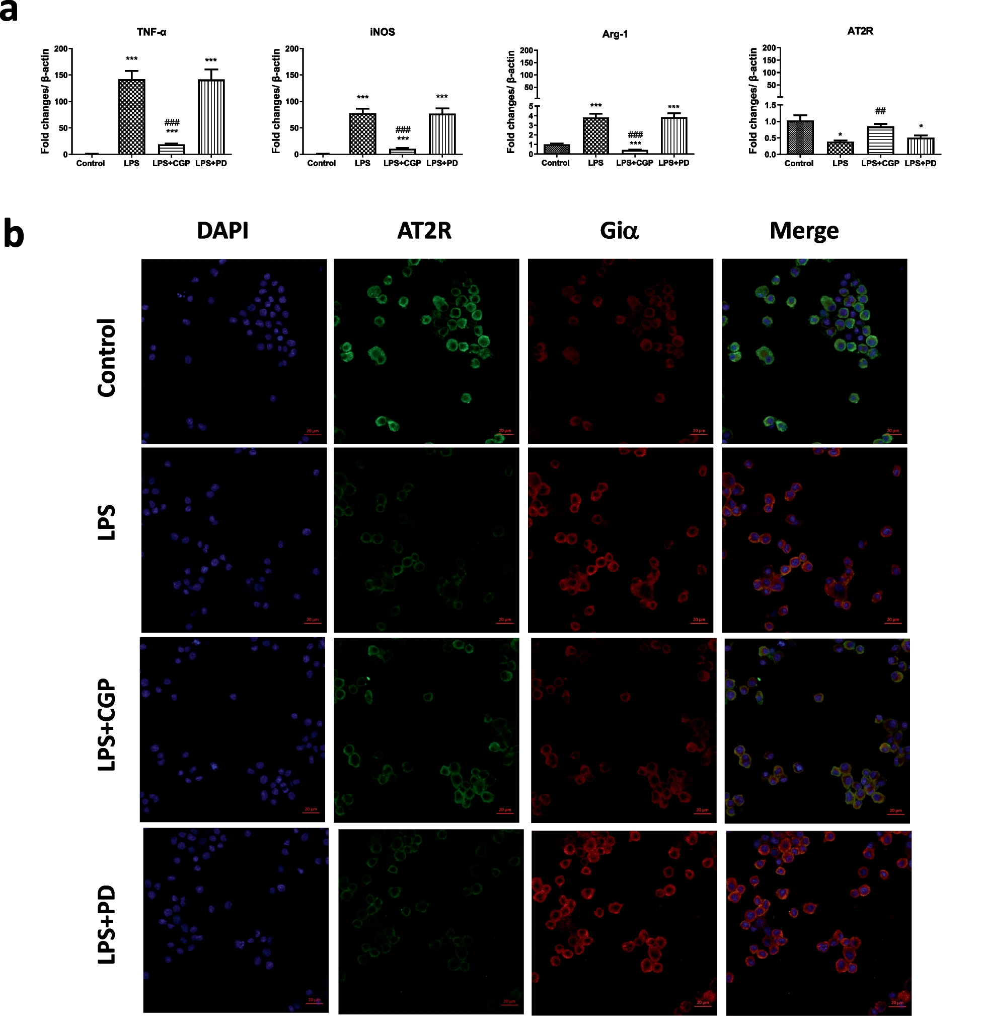 Angiotensin II Type 2 Receptor Inhibits M1 Polarization and Apoptosis of Alveolar Macrophage and Protects Against Mechanical Ventilation-Induced Lung Injury