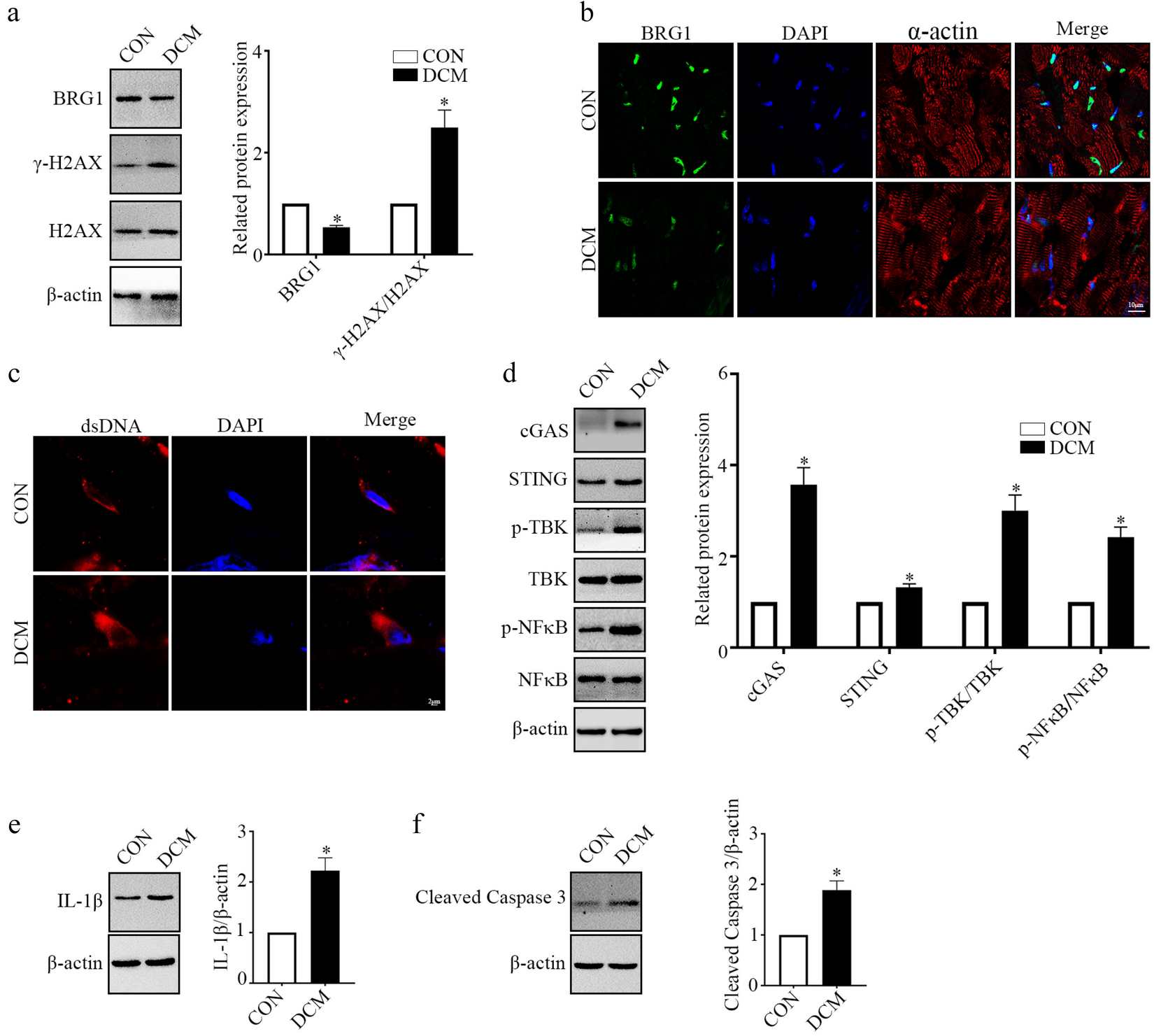 BRG1 Deficiency Promotes Cardiomyocyte Inflammation and Apoptosis by Activating the cGAS-STING Signaling in Diabetic Cardiomyopathy