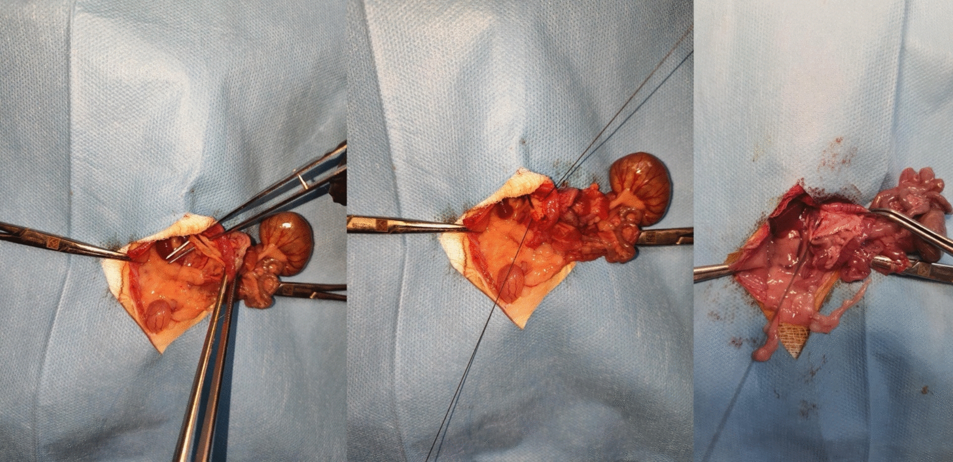 The role of serum vaspin level in the early diagnosis of mesenteric ischemia induced in experimental animal model