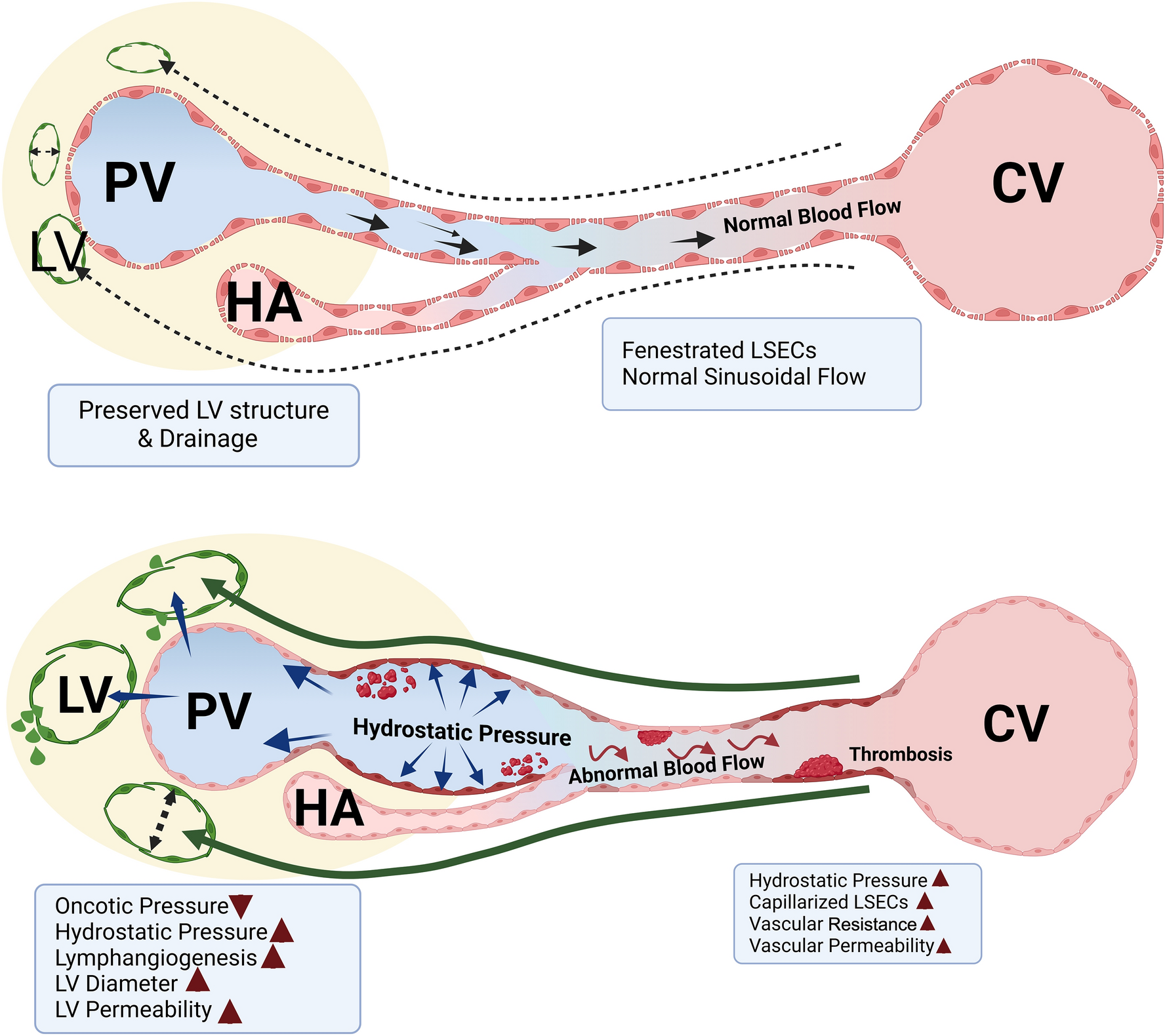 The interplay between lymphatic system and portal hypertension: a comprehensive review