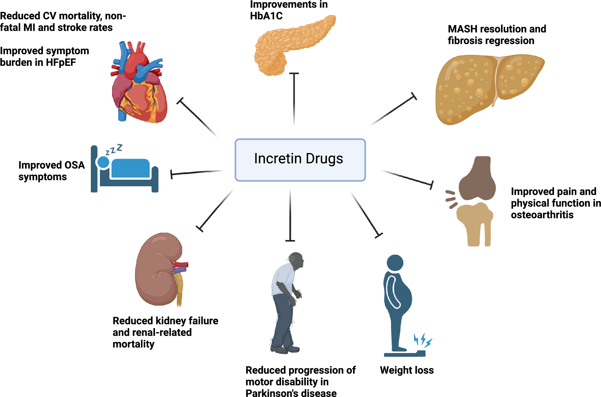 The promise of incretin-based pharmacotherapies for metabolic dysfunction-associated fatty liver disease