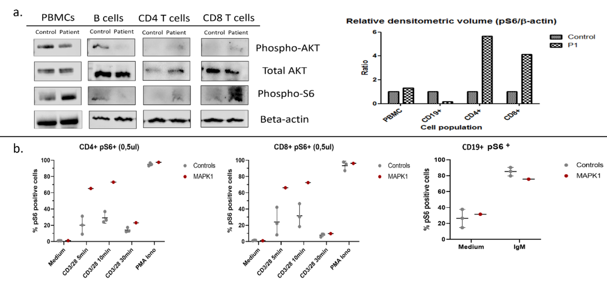 A Novel Description of Immunodeficiency and Immune Dysregulation in a 14-Year-Old Girl with Noonan Syndrome 13