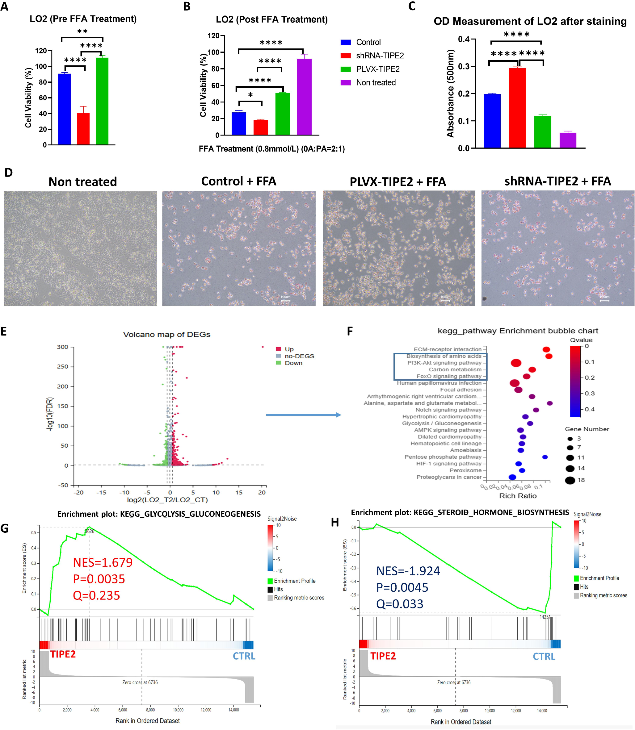 TIPE2 deficiency amplifies inflammation and immune dysregulation in MASH through modulating hepatic lipid metabolism and immune cell function