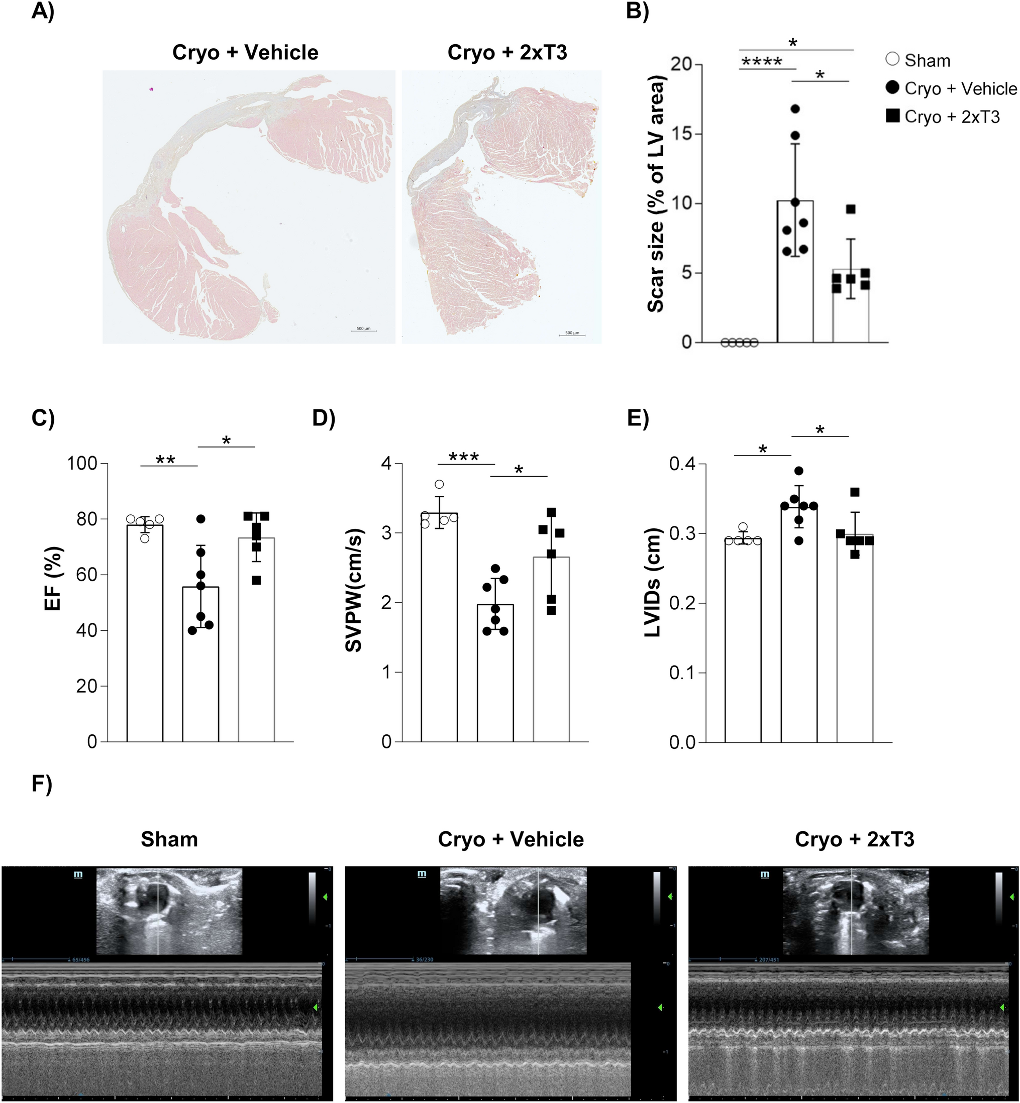 Triiodothyronine protects infarcted myocardium by reducing apoptosis and preserving mitochondria