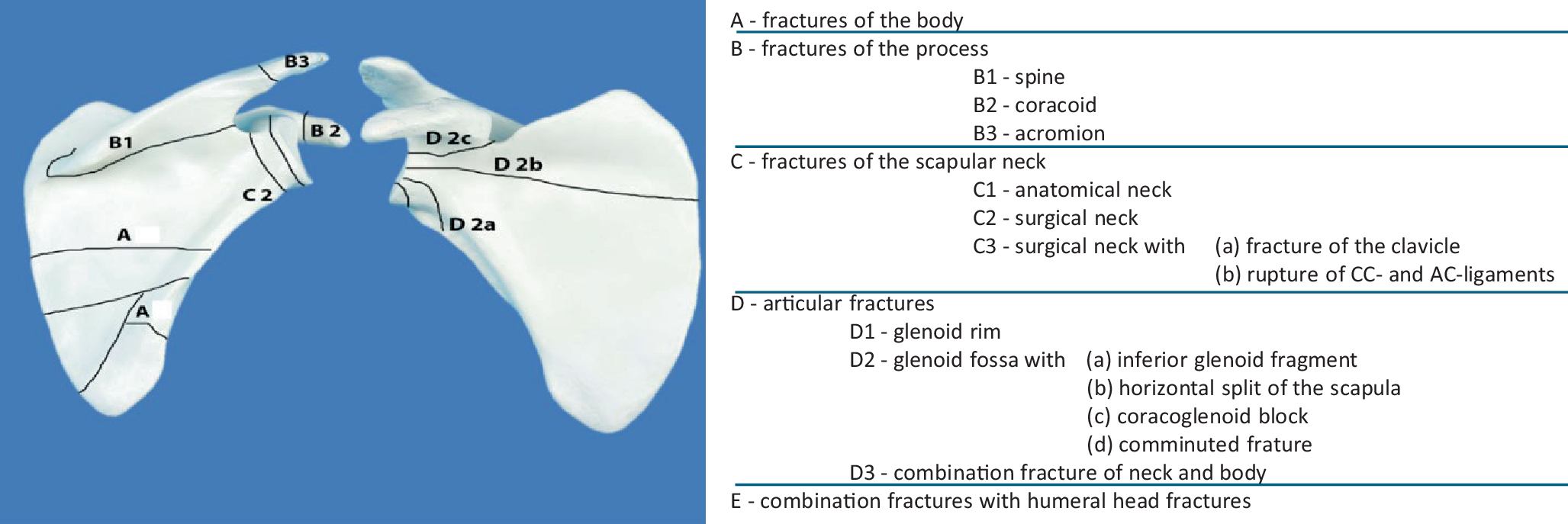 Epidemiology and current treatment of scapula fractures at a level-1 trauma center