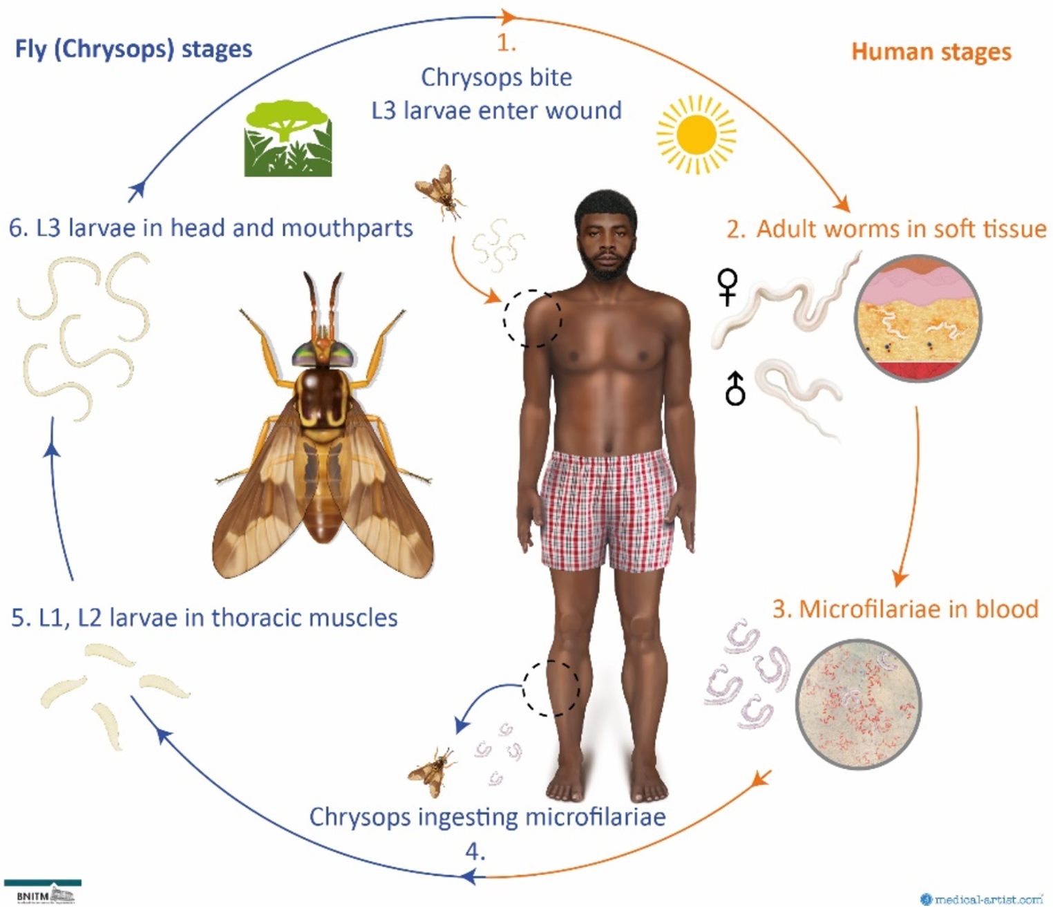 Diagnosis, management and prevention of loiasis: guideline of the German Society for Tropical Medicine, Travel Medicine, and Global Health (DTG)