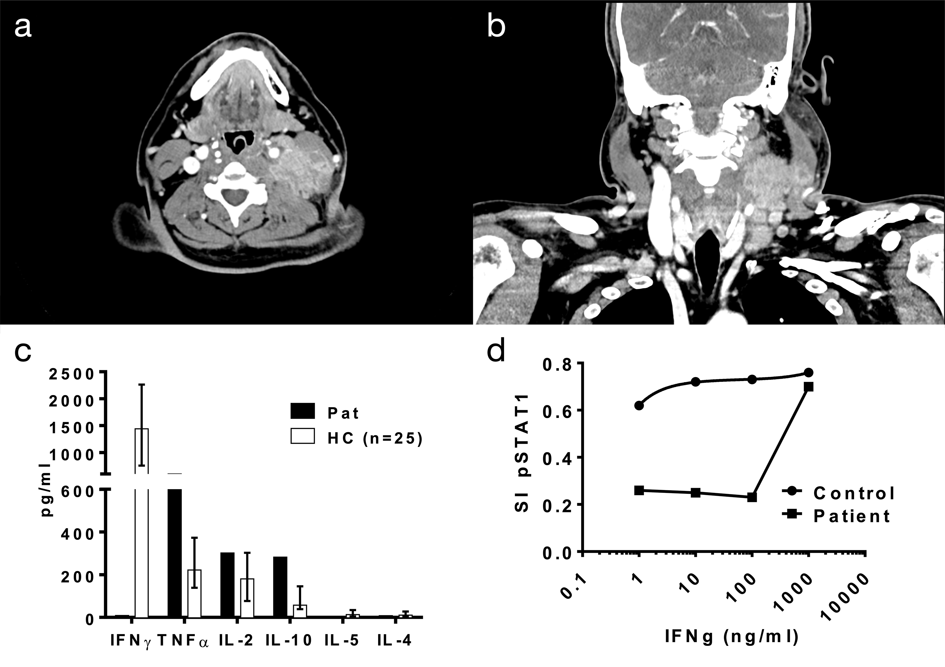 Cervical  infection in a patient with lymphadenitis and previously unknown anti-IFN-γ IgG autoantibodies