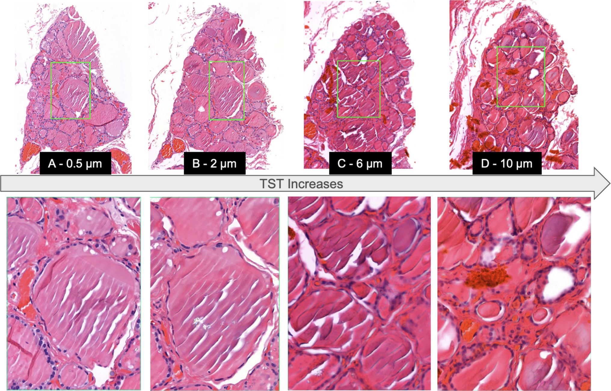 Impact of Tissue Thickness on Computational Quantification of Features in Whole Slide Images for Diagnostic Pathology