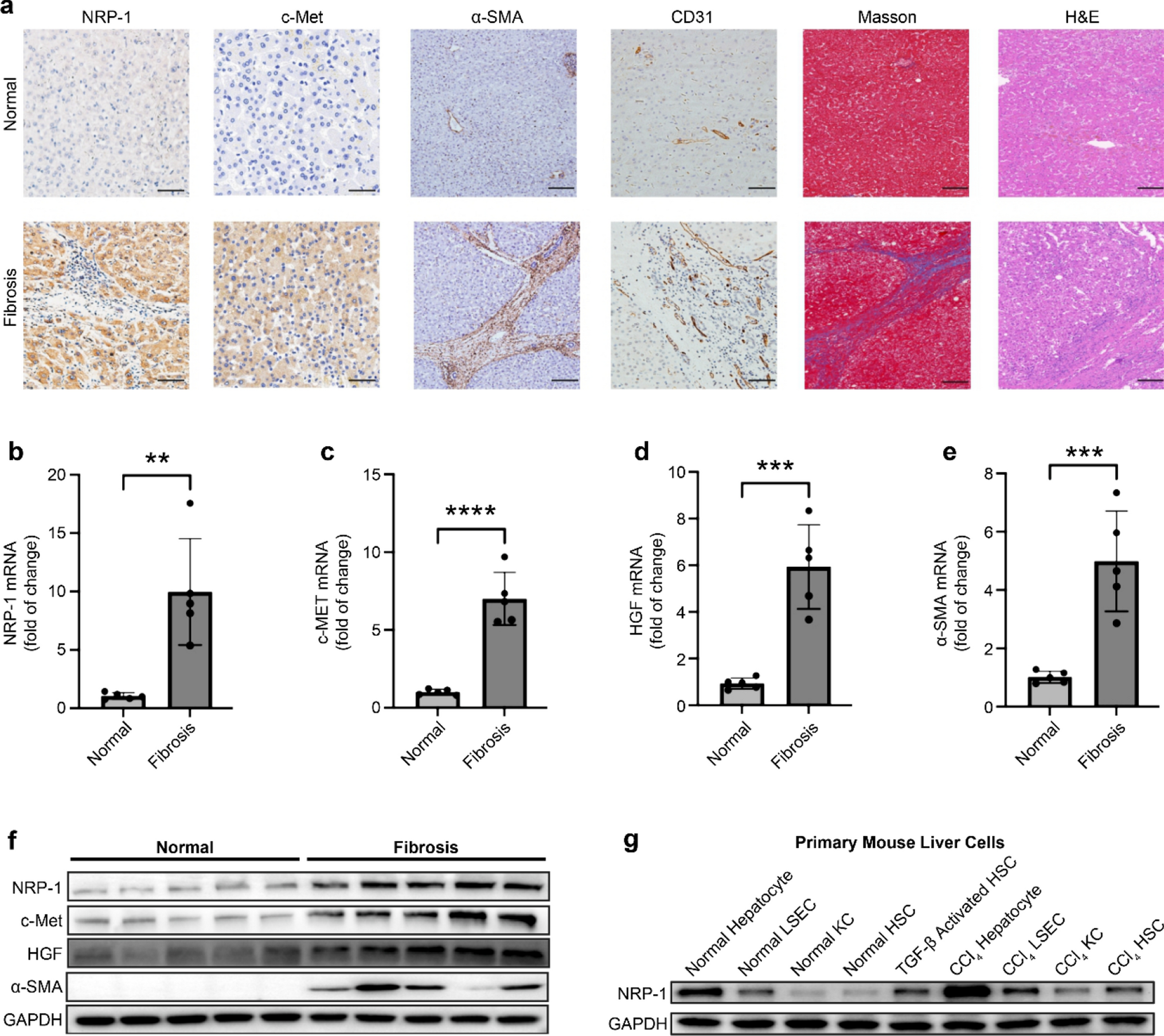 Interaction of neuropilin-1 and hepatocyte growth factor/C-Met pathway in liver fibrosis progression in hepatocyte-specific NRP-1 knockout mice