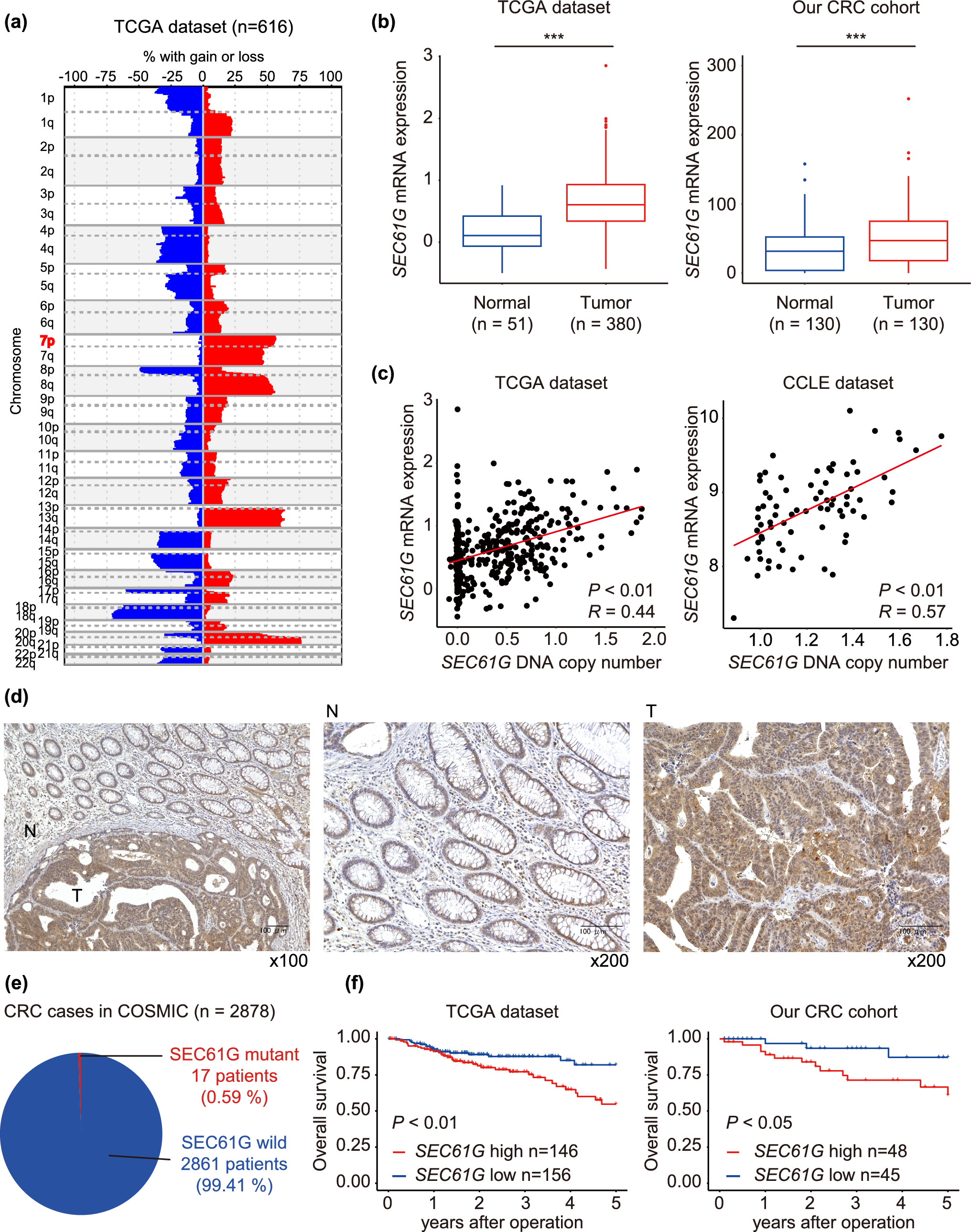 promotes colorectal cancer progression by regulating cytosolic Ca concentration