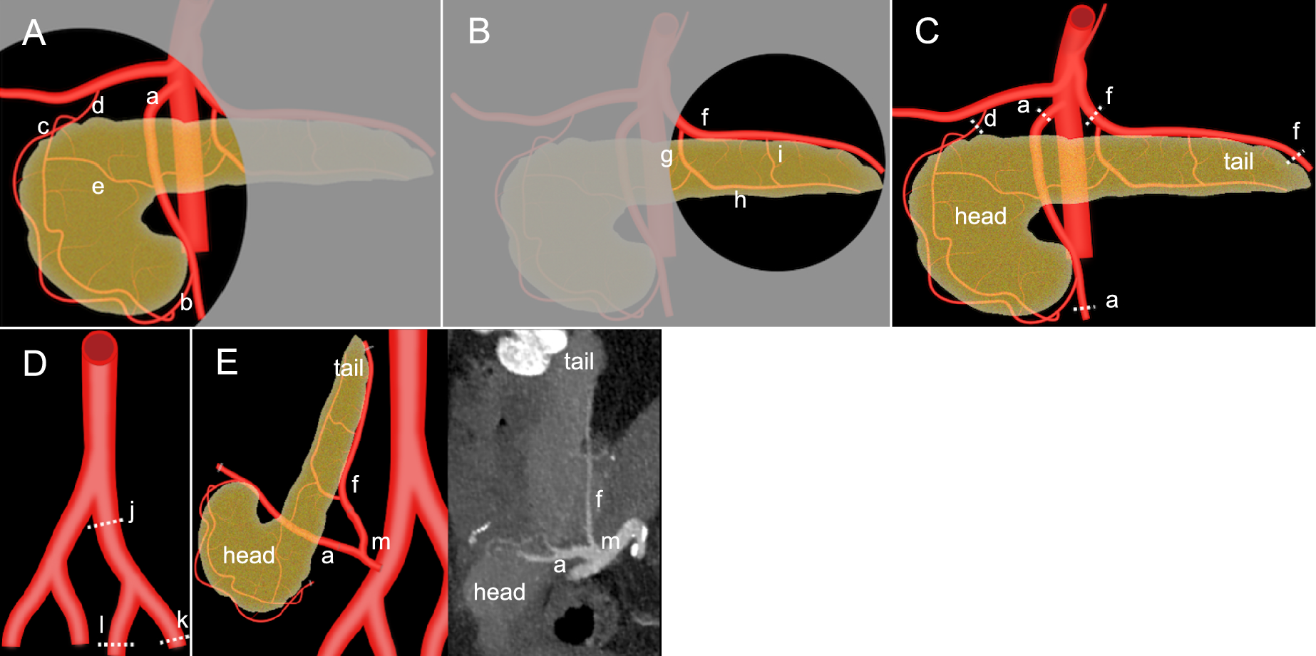 Multimodality diagnostic imaging and role of interventional radiology in pancreas transplantation