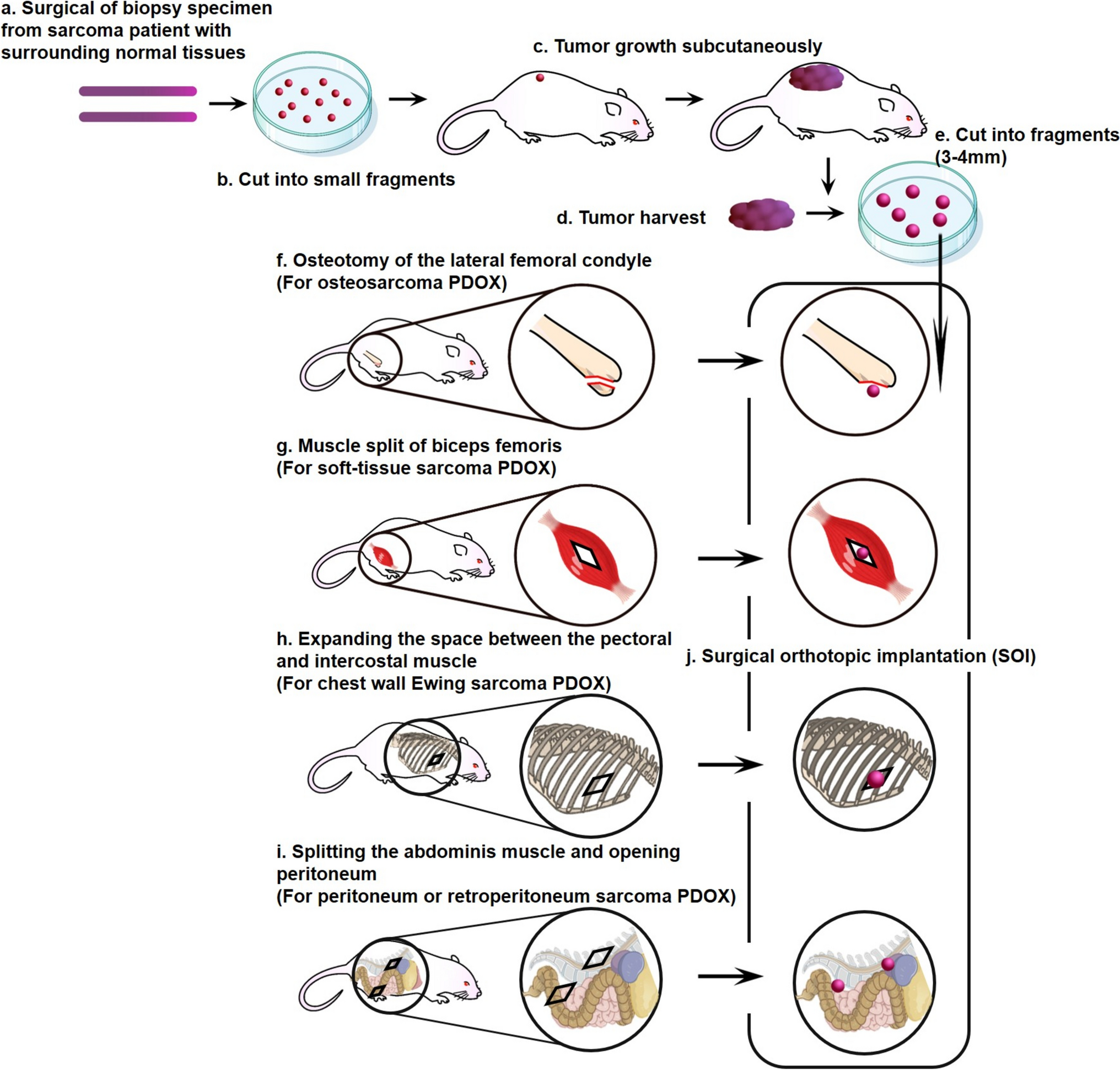 A perspective on patient-derived orthotopic xenograft (PDOX) mouse models for identification of novel and individualized treatment for sarcoma