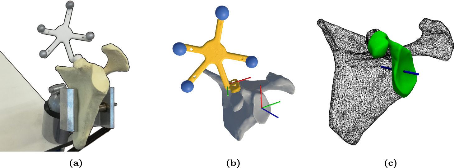 Evaluation of augmented reality guidance for glenoid pin placement in total shoulder arthroplasty
