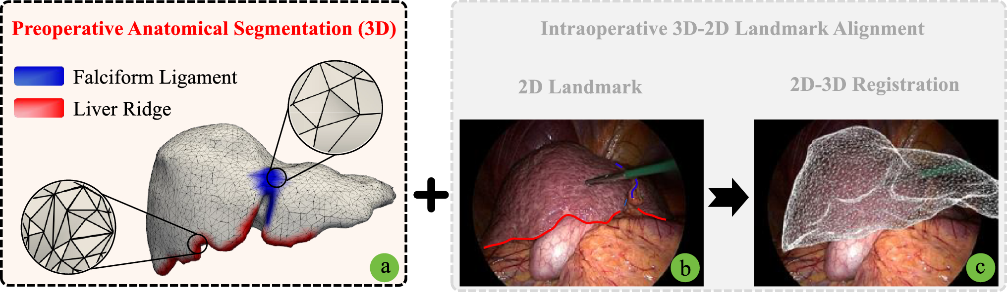 Two-stream MeshCNN for key anatomical segmentation on the liver surface