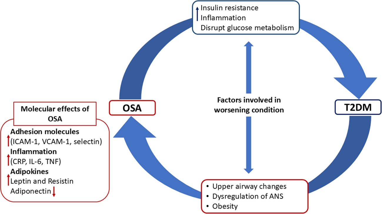 Interrelationship between type 2 diabetes mellitus and obstructive sleep apnea: Experts’ opinion with focus on development of a screening tool