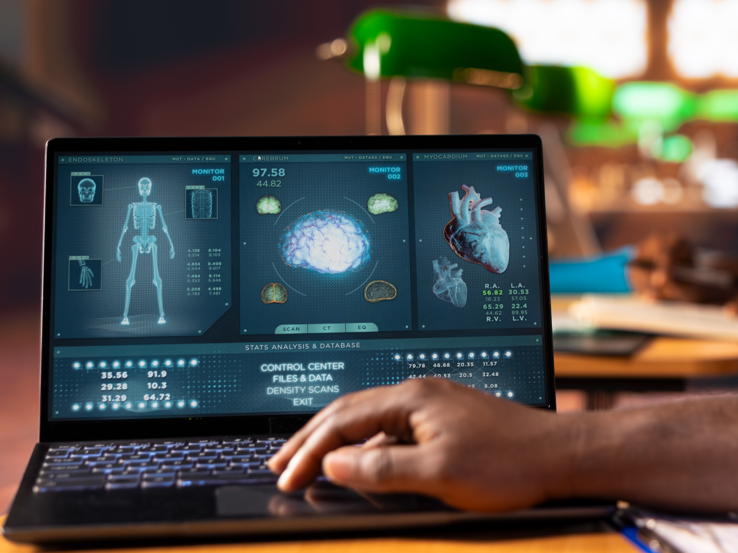Prediction of Percutaneous Coronary Intervention Success in Patients With Moderate to Severe Coronary Artery Calcification Using Machine Learning Based on Coronary Angiography: Prospective Cohort Study