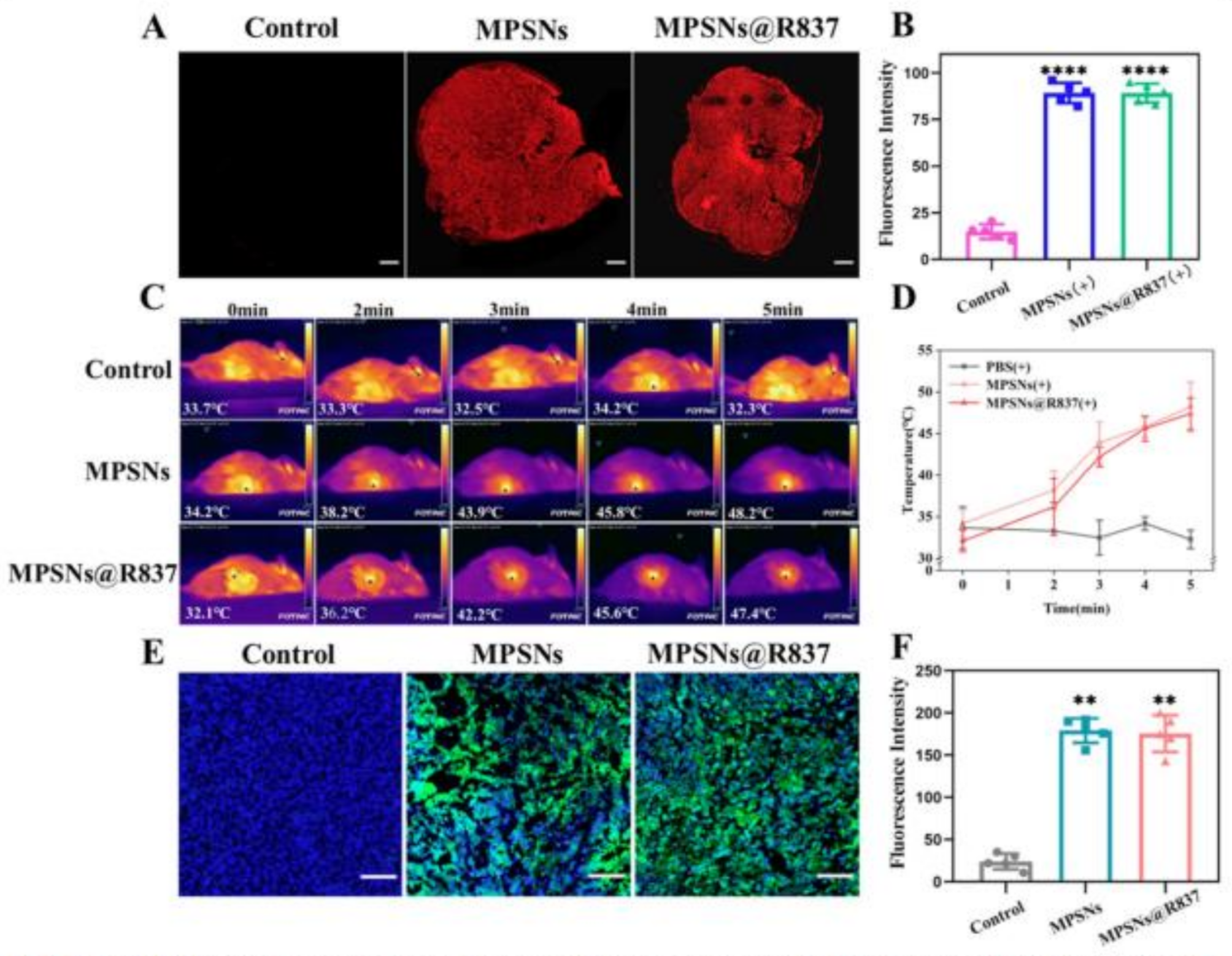 Correction to: Light-triggered multifunctional nanoplatform for efficient cancer photo-immunotherapy