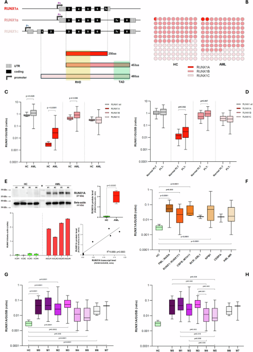 RUNX1A isoform is overexpressed in acute myeloid leukemia and is associated with FLT3 internal tandem duplications