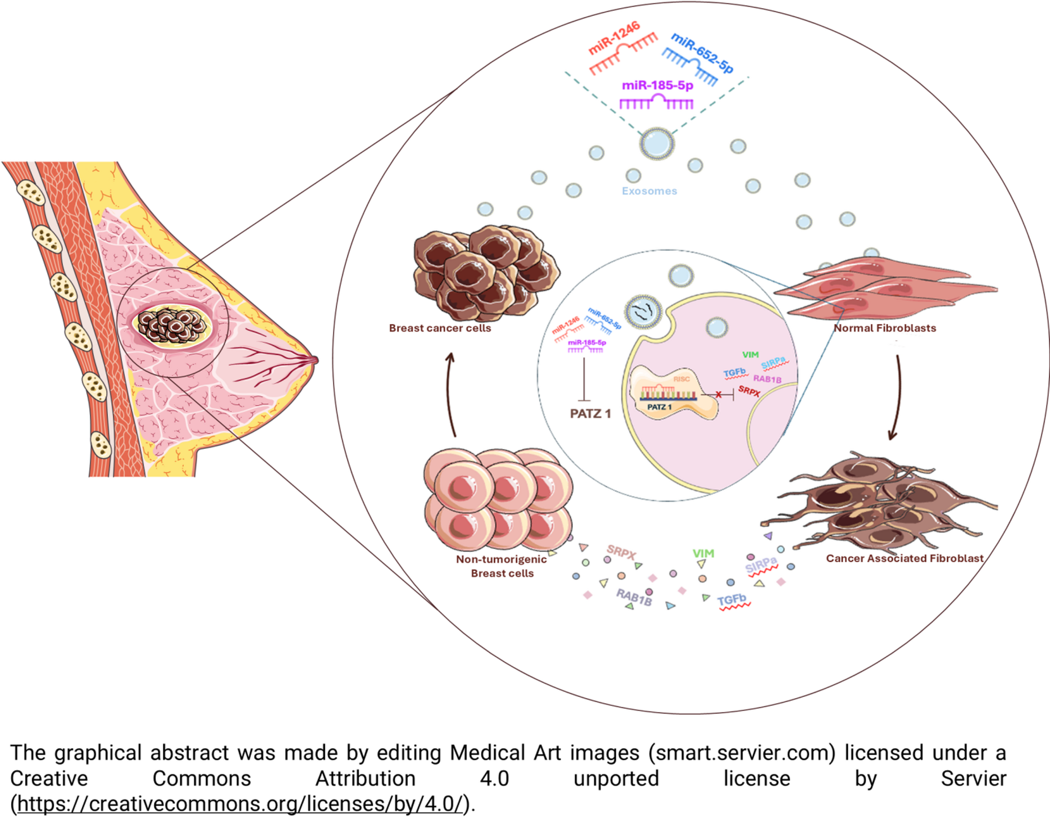 Fibroblasts activated by miRs-185-5p, miR-652-5p, and miR-1246 shape the tumor microenvironment in triple-negative breast cancer via PATZ1 downregulation
