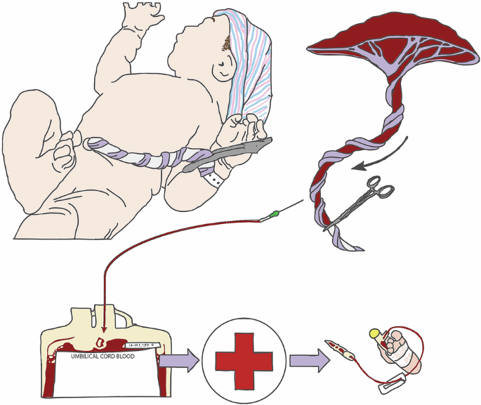 Three studies needed to inform the design of the U-BET (umbilical cord blood for extremely low-gestational-age transfusions) clinical trial