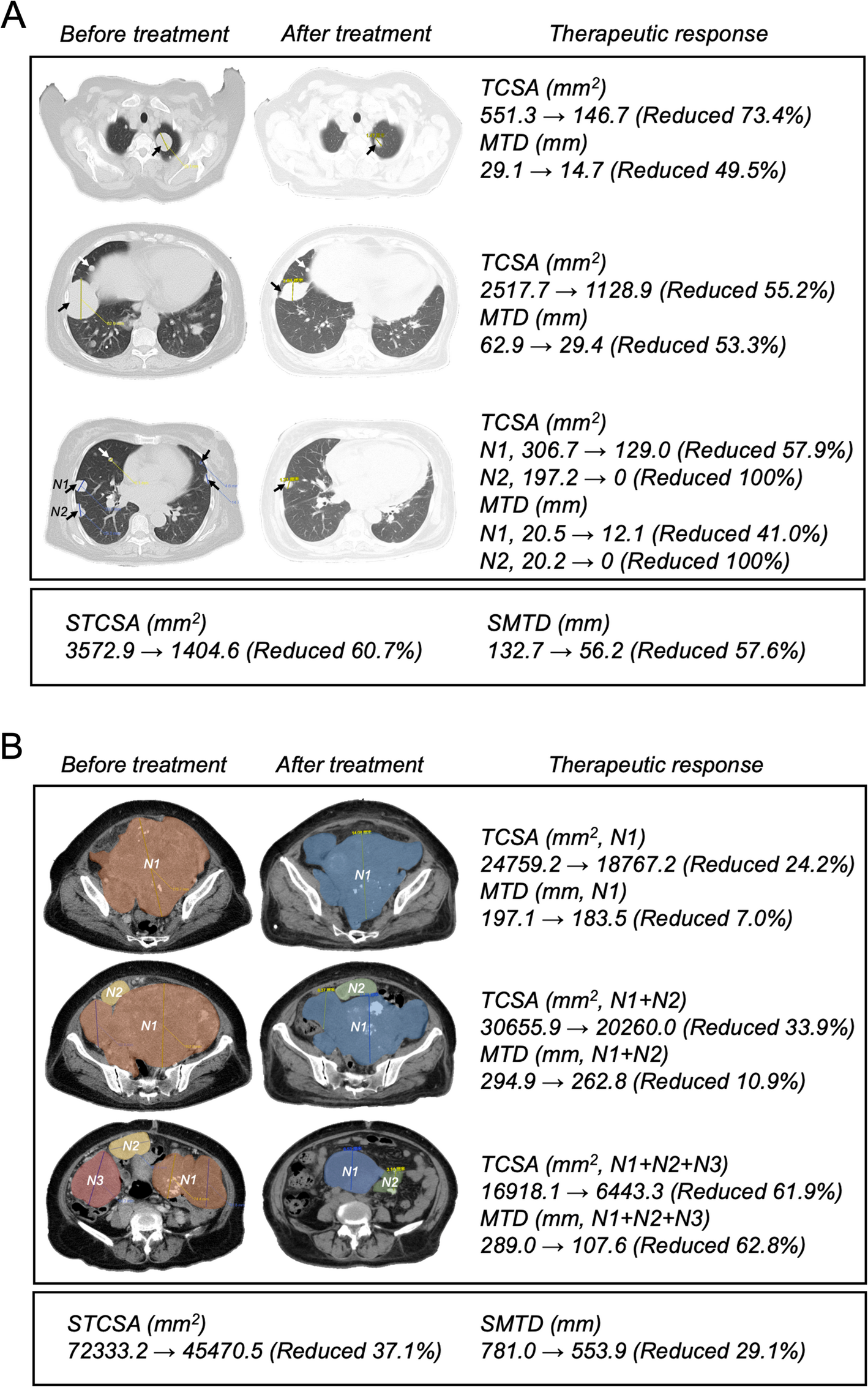 TSC2-mutated perivascular epithelioid cell tumor with partial response to mTOR inhibition: a case report and literature review