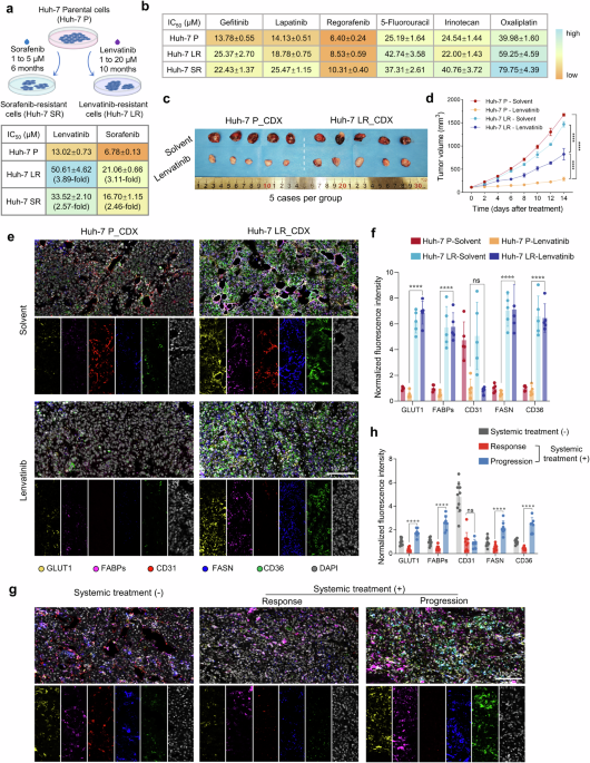 Targeting AKR1B1 inhibits metabolic reprogramming to reverse systemic therapy resistance in hepatocellular carcinoma