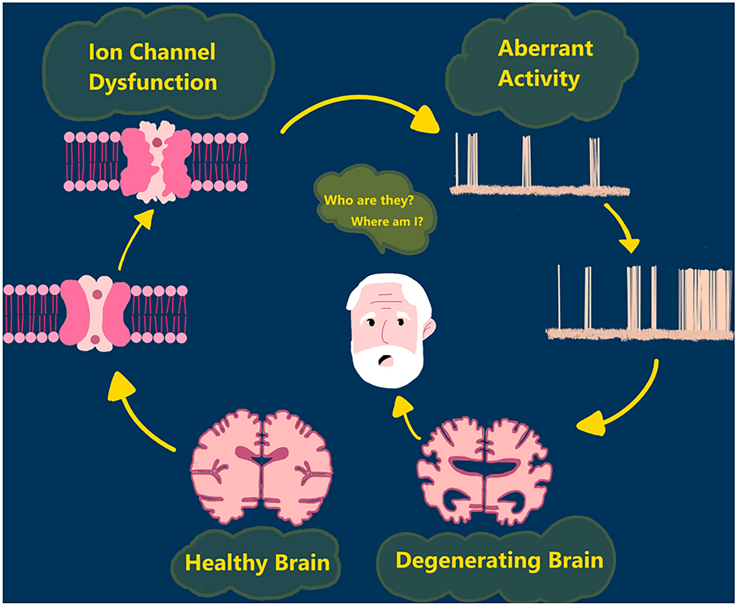Role of Ion Channels in Alzheimer’s Disease Pathophysiology