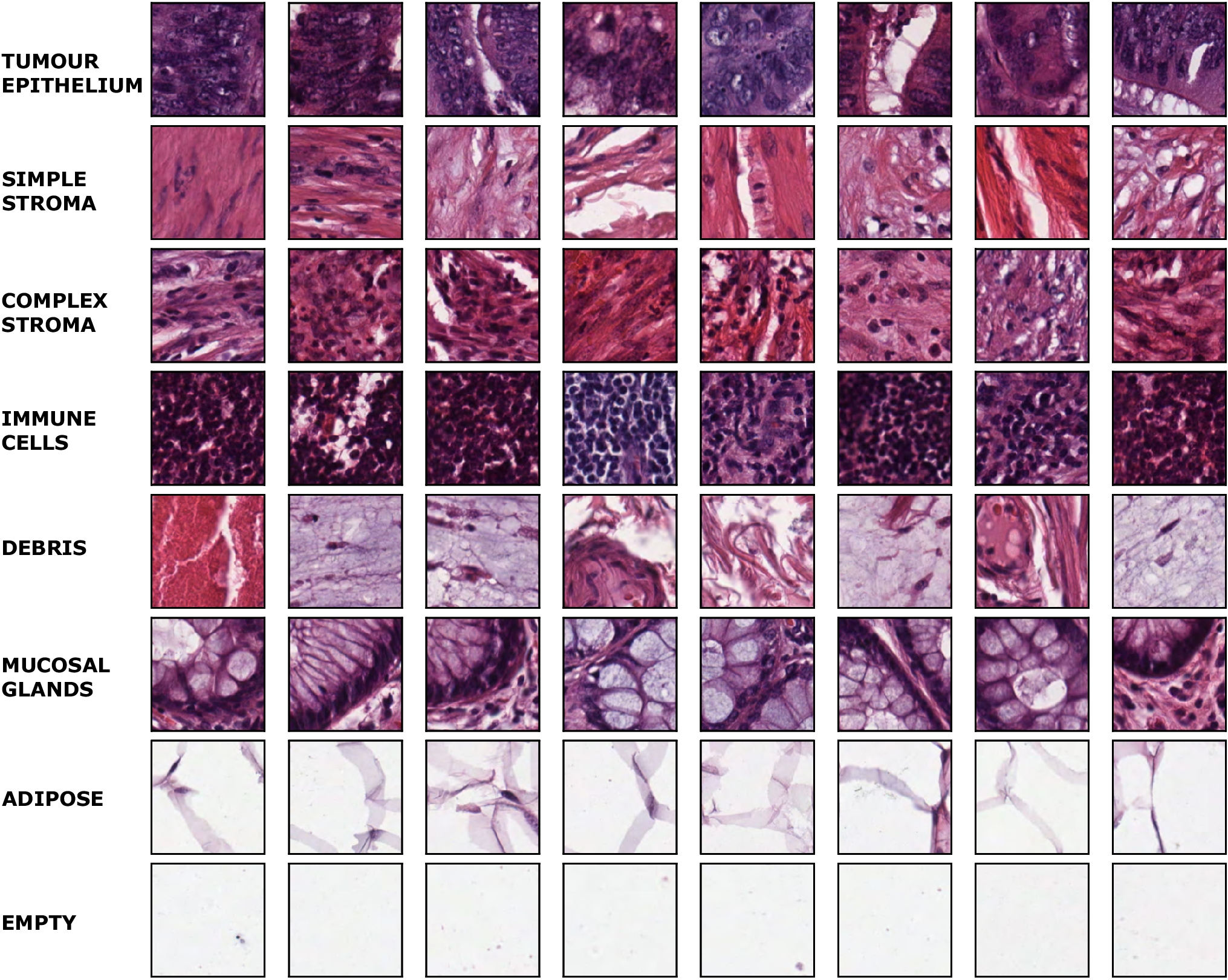Ensemble of Handcrafted and Learned Features for Colorectal Cancer Classification