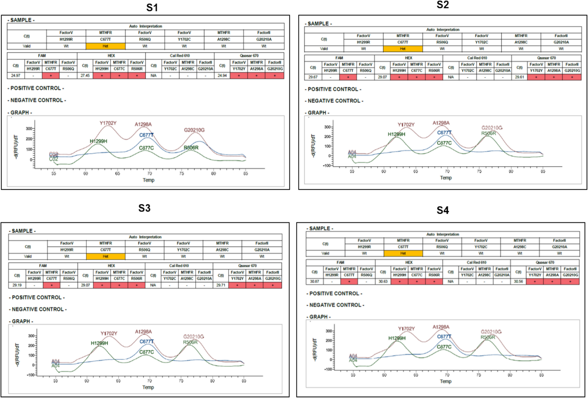 Methylomic Changes in MTHFR Promoter Region, along with the Heterozygous C677T Polymorphism, Contribute to the Risk of Thrombotic Stroke