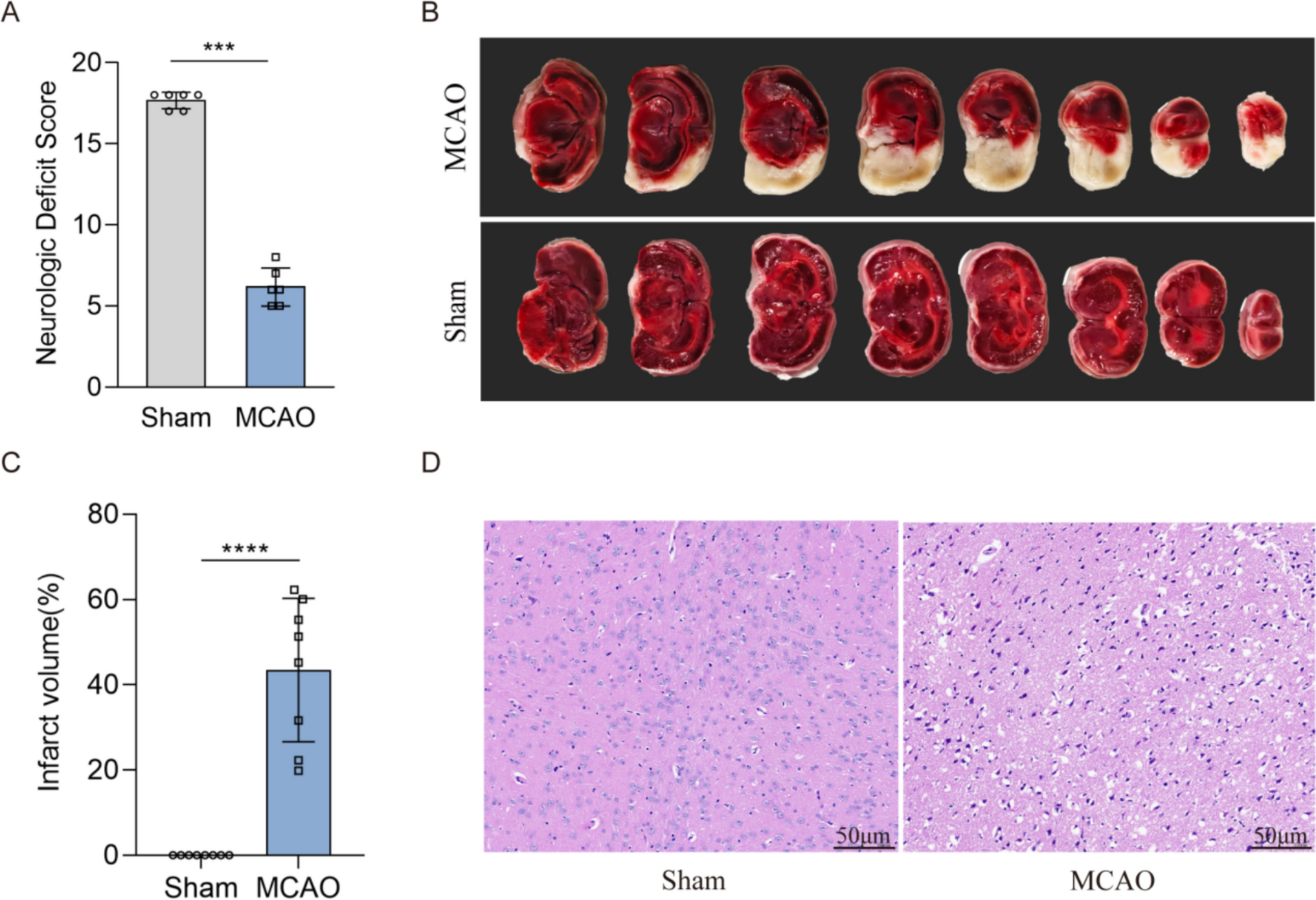 Exploring Core Genes Involved in Ischemic Stroke and the Therapeutic Potential of Hyperbaric Oxygen: Insights from Transcriptomic Analysis