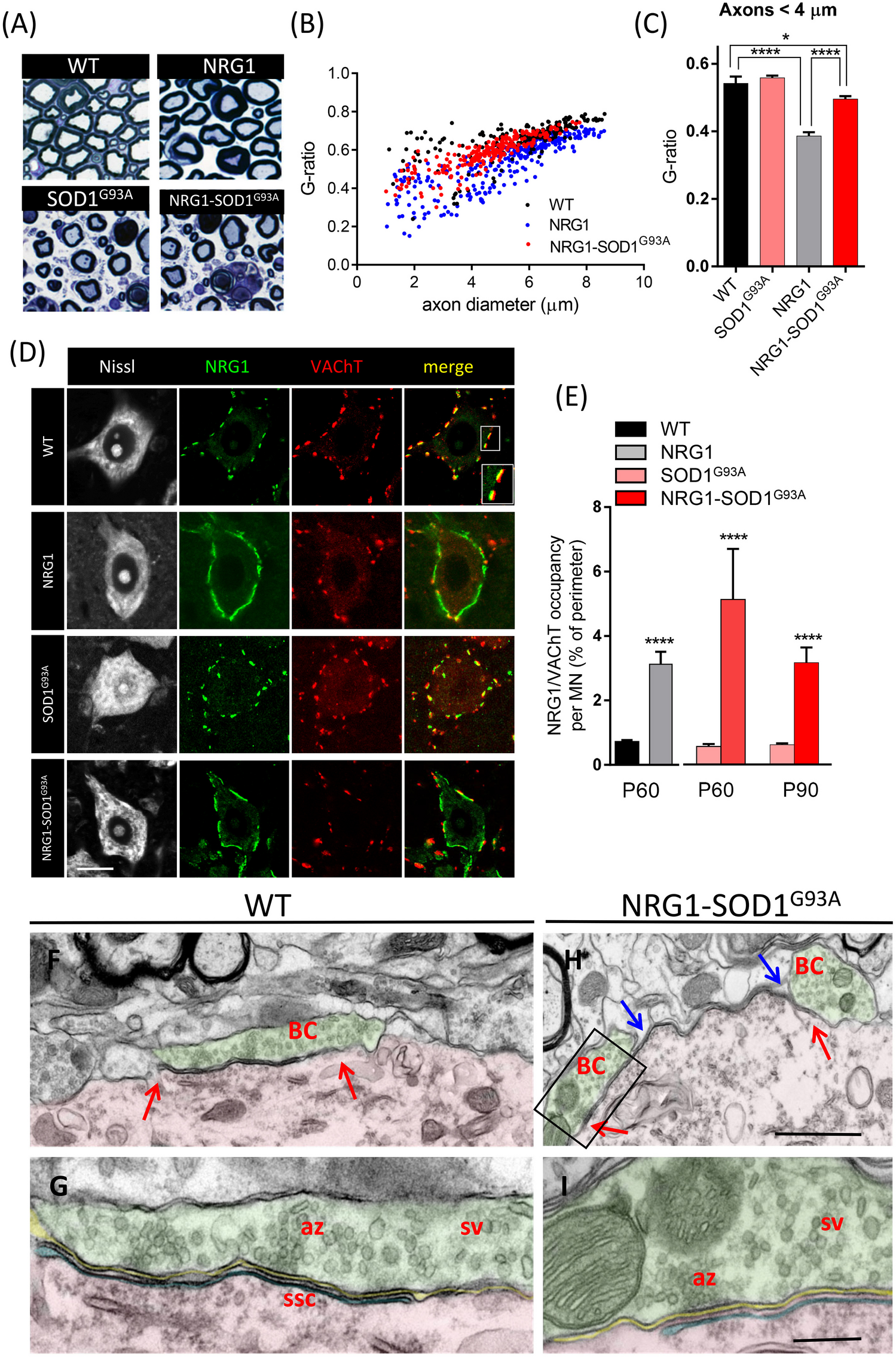 Persistent NRG1 Type III Overexpression in Spinal Motor Neurons Has No Therapeutic Effect on ALS-Related Pathology in SOD1 Mice