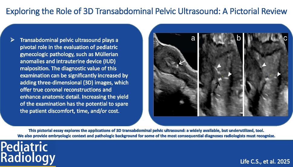 Exploring the role of 3D transabdominal pelvic ultrasound: a pictorial review