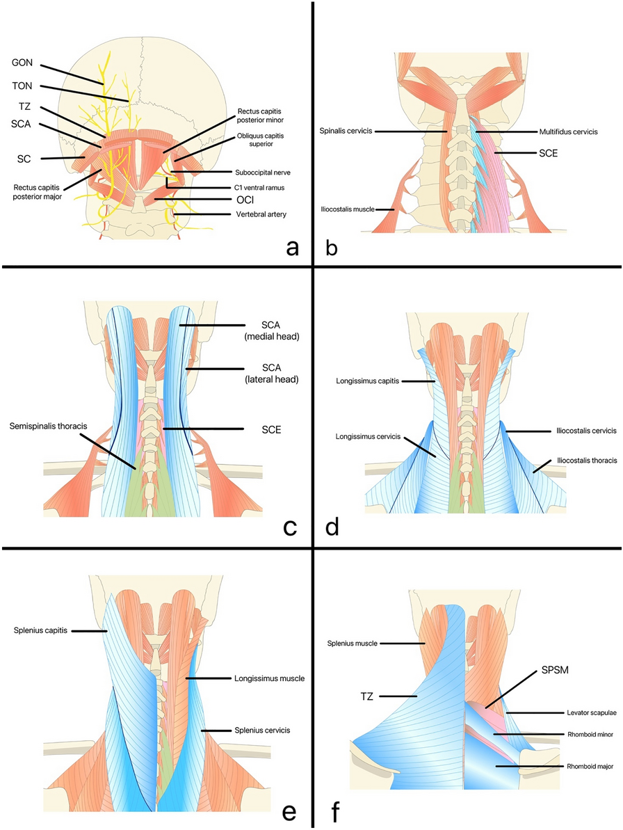 Understanding the Anatomy of Posterior Cervical Interfascial Space: Implications for Regional Blocks and Pain Management. A Narrative Review