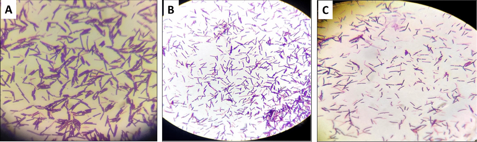 Strain-specific interactions between probiotic bacteria and nanocurcumin: implications for gastrointestinal health